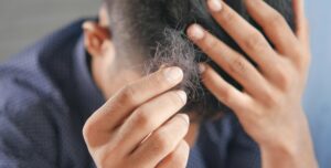 Can STIs cause hair loss?