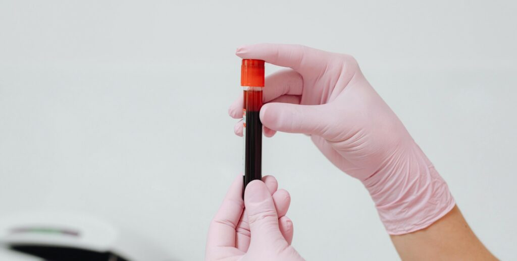 Sunset in the mountains