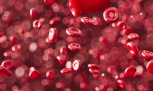 Do I have anaemia?