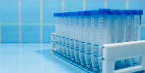 With a shortage of blood test tubes affecting the UK, Better2Know is continuing to test as normal