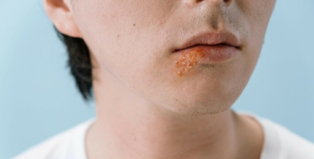 Sunset in the mountains