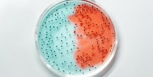 Chlamydia vs Gonorrhoea: how do you tell them apart?